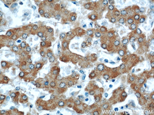 [55210-1-AP-20UL] ACADM Polyclonal antibody