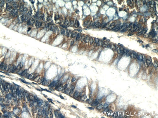 [55212-1-AP-150UL] PLS1 Polyclonal antibody