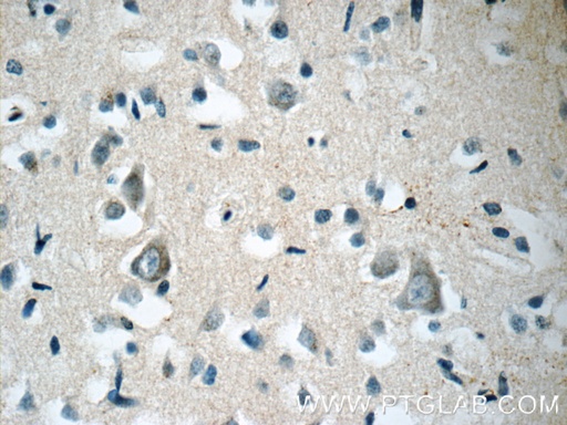 [55213-1-AP-20UL] ARHGEF4 Polyclonal antibody
