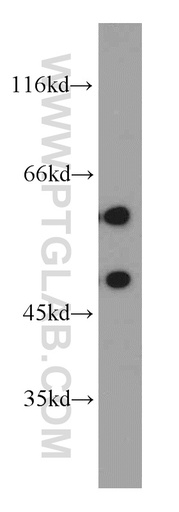 [55214-1-AP-150UL] GDI1 Polyclonal antibody