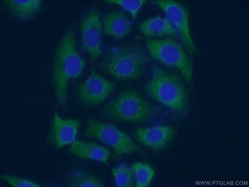 [55215-1-AP-150UL] EPHA5 Polyclonal antibody