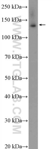 [55220-1-AP-20UL] BNC2 Polyclonal antibody
