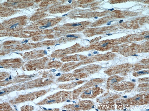 [55222-1-AP-150UL] HCN1 Polyclonal antibody