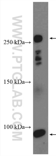 [55228-1-AP-20UL] C4-B Alpha Chain/C4b-B/C4d-B Polyclonal antibody