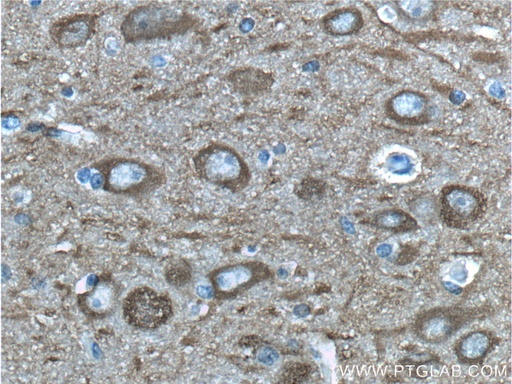 [55235-1-AP-150UL] NSE/ENO2-specific Polyclonal antibody