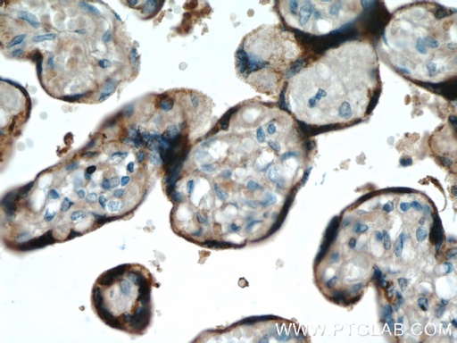 [55236-1-AP-20UL] Placental lactogen Polyclonal antibody