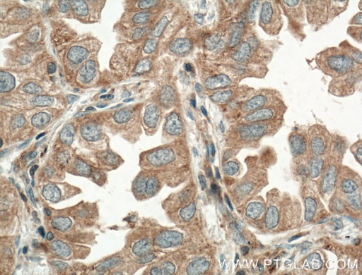 [55239-1-AP-150UL] TPSD1 Polyclonal antibody