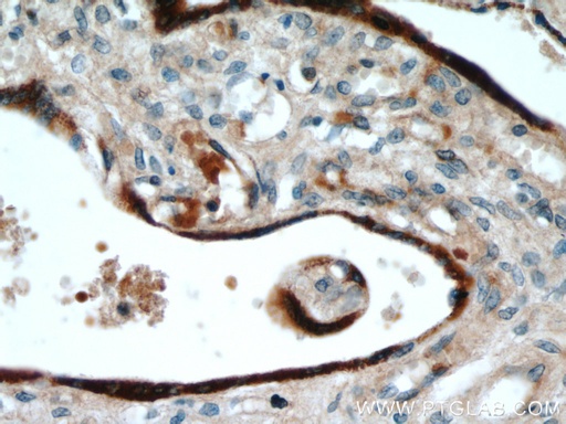 [55240-1-AP-150UL] GH2 Polyclonal antibody