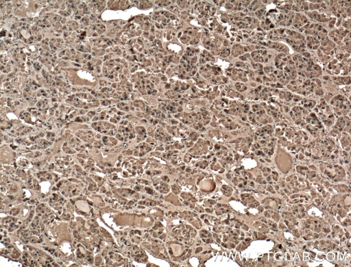 [55243-1-AP-150UL] GH1 Polyclonal antibody