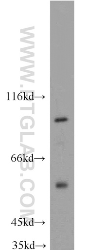 [55244-1-AP-20UL] MAP4K2 Polyclonal antibody