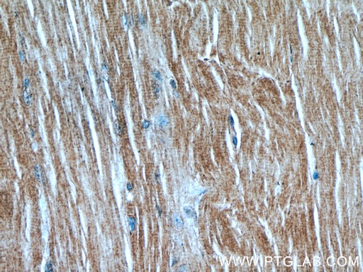 [55247-1-AP-150UL] MAP4K4 Polyclonal antibody