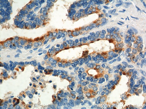 [55249-1-AP-150UL] GPR55 Polyclonal antibody