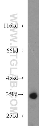 [55255-1-AP-20UL] RCBTB1 Polyclonal antibody
