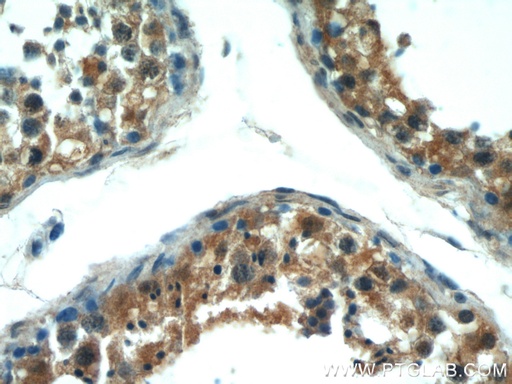 [55260-1-AP-150UL] VDAC3 Polyclonal antibody