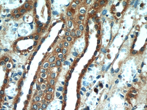 [55261-1-AP-150UL] VDAC2 Polyclonal antibody