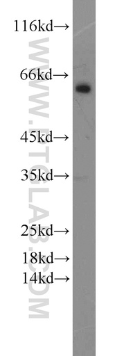 [55263-1-AP-20UL] MAOB Polyclonal antibody