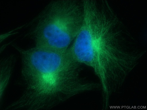 [55268-1-AP-150UL] Alpha Parvin/Actopaxin Polyclonal antibody
