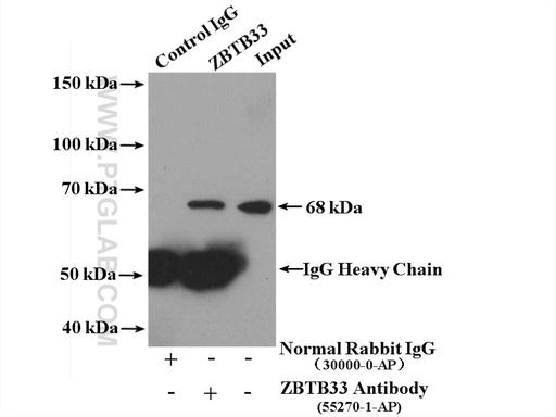 [55270-1-AP-20UL] ZBTB33 Polyclonal antibody