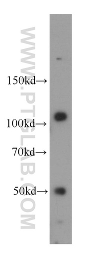[55277-1-AP-150UL] CASK Polyclonal antibody