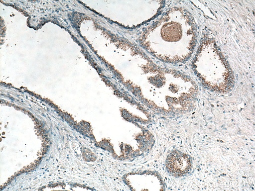 [55279-1-AP-150UL] CTAGE5 Polyclonal antibody