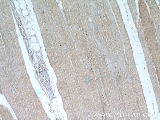 [55281-1-AP-20UL] OBSCN Polyclonal antibody