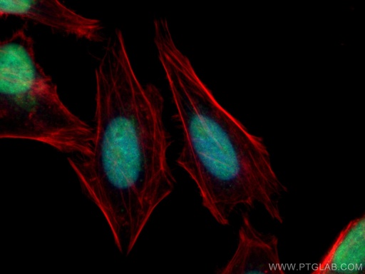 [55290-1-AP-150UL] FBXW7 Polyclonal antibody