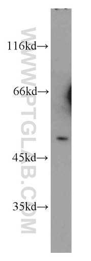[55291-1-AP-150UL] CHRNA10 Polyclonal antibody
