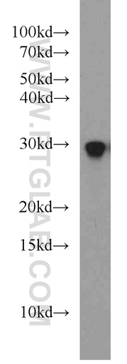 [55295-1-AP-150UL] RAB8B Polyclonal antibody