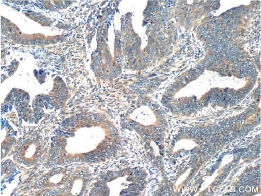[55296-1-AP-150UL] RAB8A Polyclonal antibody