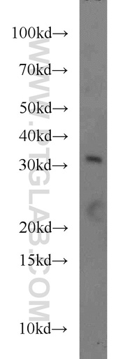 [55301-1-AP-150UL] FOXE3 Polyclonal antibody