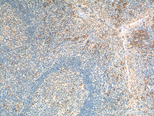 [55302-1-AP-20UL] HTR1A Polyclonal antibody