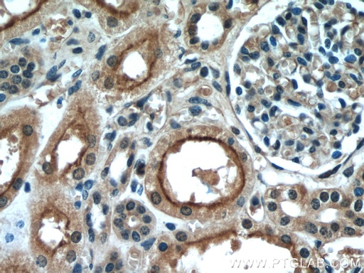 [55306-1-AP-150UL] PDE2A Polyclonal antibody