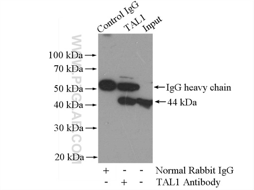 [55317-1-AP-150UL] TAL1 Polyclonal antibody