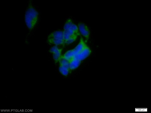 [55320-1-AP-150UL] SH2D5 Polyclonal antibody