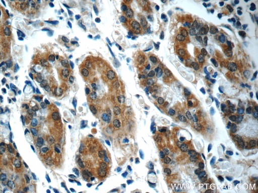 [55333-1-AP-20UL] SEPN1 Polyclonal antibody