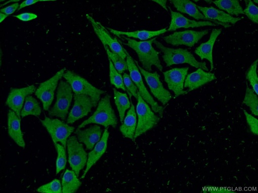 [55334-1-AP-20UL] SCN10A Polyclonal antibody