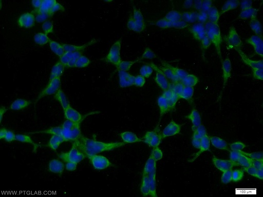 [55335-1-AP-150UL] STK38 Polyclonal antibody