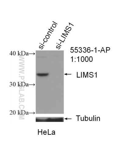 [55336-1-AP-20UL] LIMS1 Polyclonal antibody