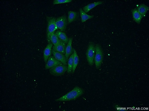 [55338-1-AP-150UL] RNASE3 Polyclonal antibody