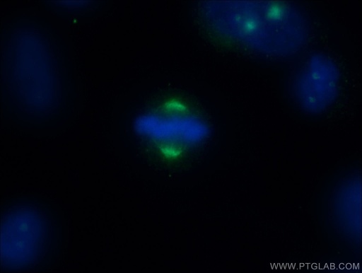 [55341-1-AP-20UL] CEP78 Polyclonal antibody
