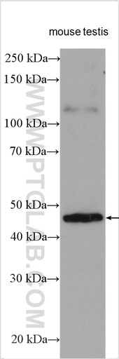 [55346-1-AP-20UL] PRKACG Polyclonal antibody