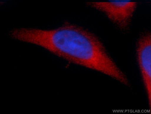 [55352-1-AP-150UL] SIDT1 Polyclonal antibody