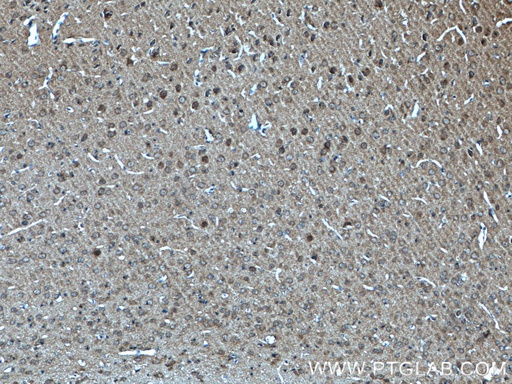[55362-1-AP-150UL] p140Cap Polyclonal antibody