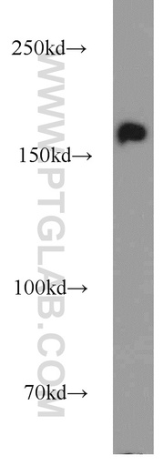 [55364-1-AP-150UL] ANKRD11 Polyclonal antibody