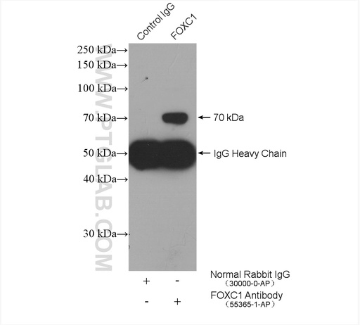 [55365-1-AP-150UL] FOXC1 Polyclonal antibody