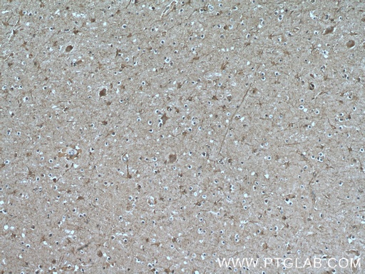[55376-1-AP-150UL] GJC2 Polyclonal antibody