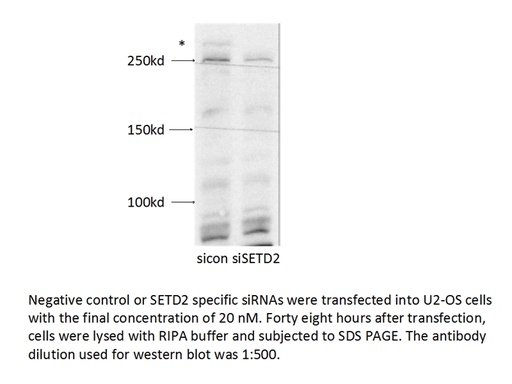 [55377-1-AP-150UL] SETD2 Polyclonal antibody