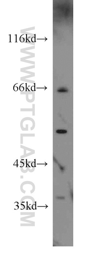 [55379-1-AP-150UL] HLA-F Polyclonal antibody