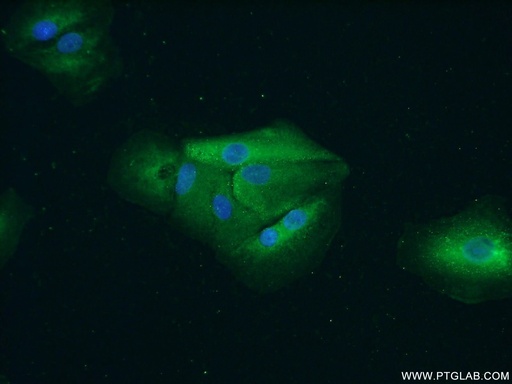 [55380-1-AP-20UL] PYGB Polyclonal antibody