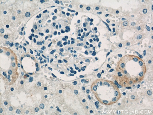 [55382-1-AP-150UL] PKA C-beta-specific Polyclonal antibody